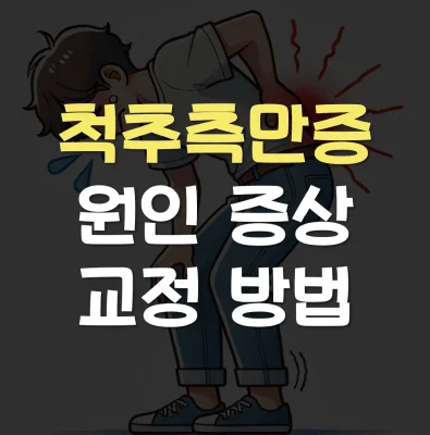 척추측만증-원인