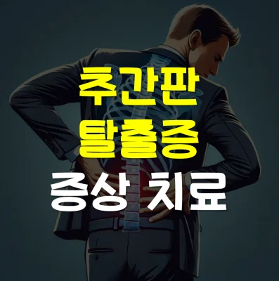 추간판-탈출증